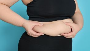 Choosing the Right Bariatric Surgery for You