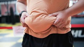 Does Cortisol Cause Belly Fat? How Stress Affects Weight Loss