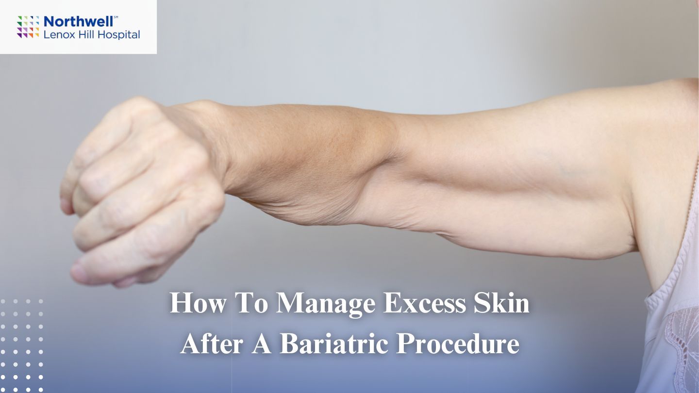 How to Manage Excess Skin After a Bariatric Procedure