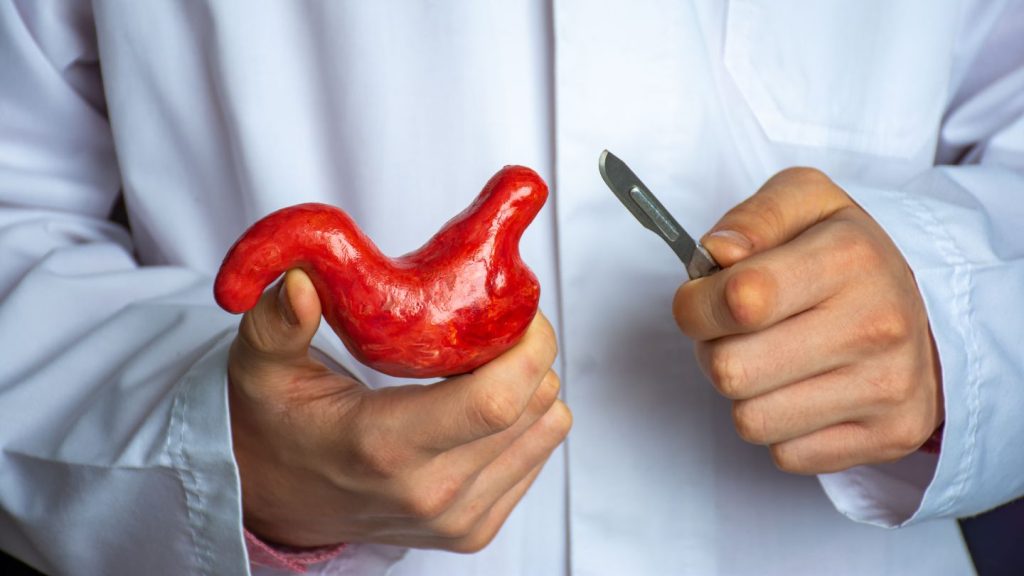 What If Gastric Sleeve Surgery Doesn’t Work?