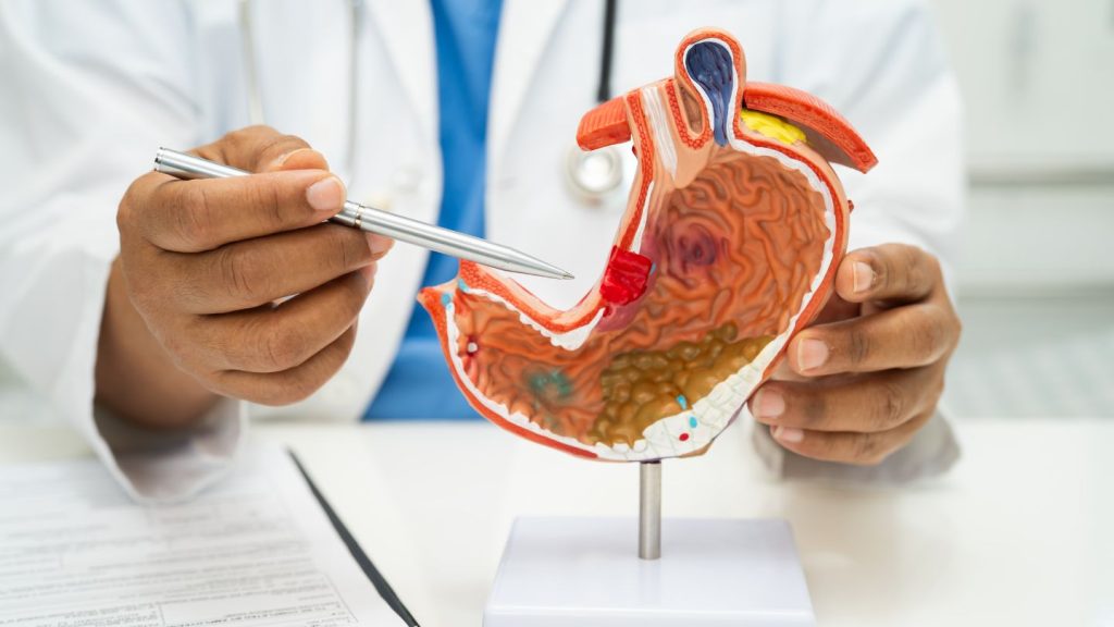 Why Choose a Permanent Procedure Like the Gastric Sleeve?