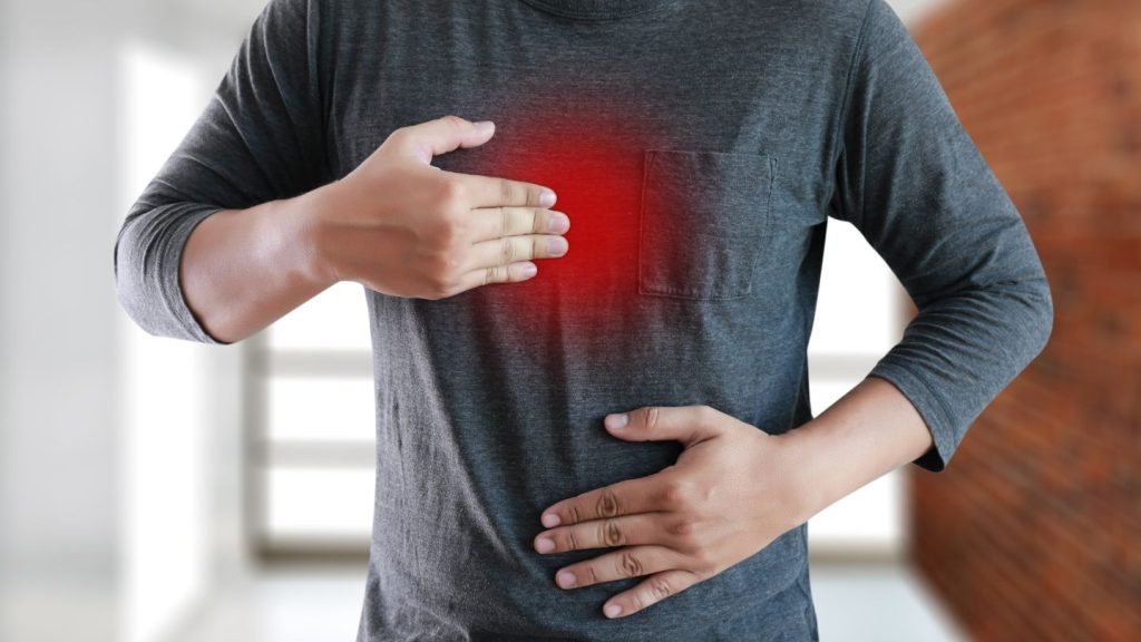 Persistent or Severe Acid Reflux