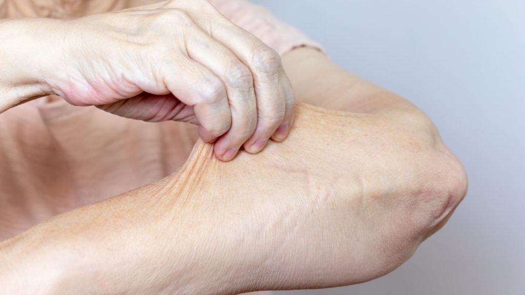 How to Tighten Skin After Weight Loss Surgery